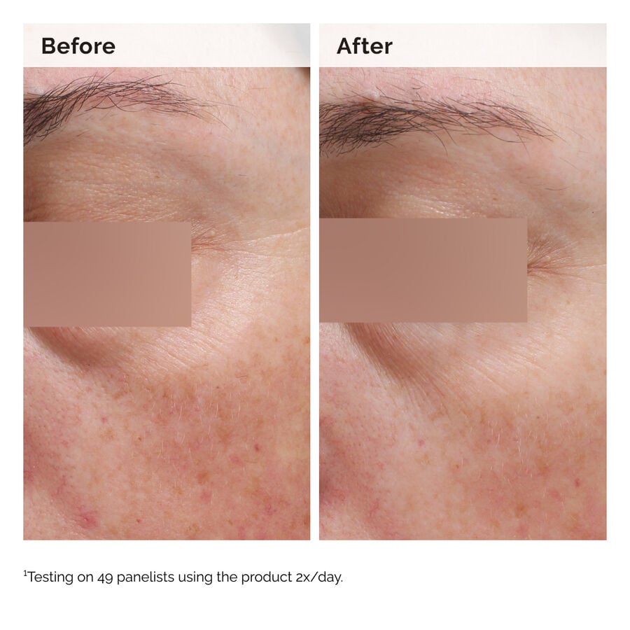 niacinamide-5-face-and-body-emulsion-a2 2024-08-23-ORD-Nia-5pct-Face-Body-B-A-Elasticity-Global-02-1x1.jpg