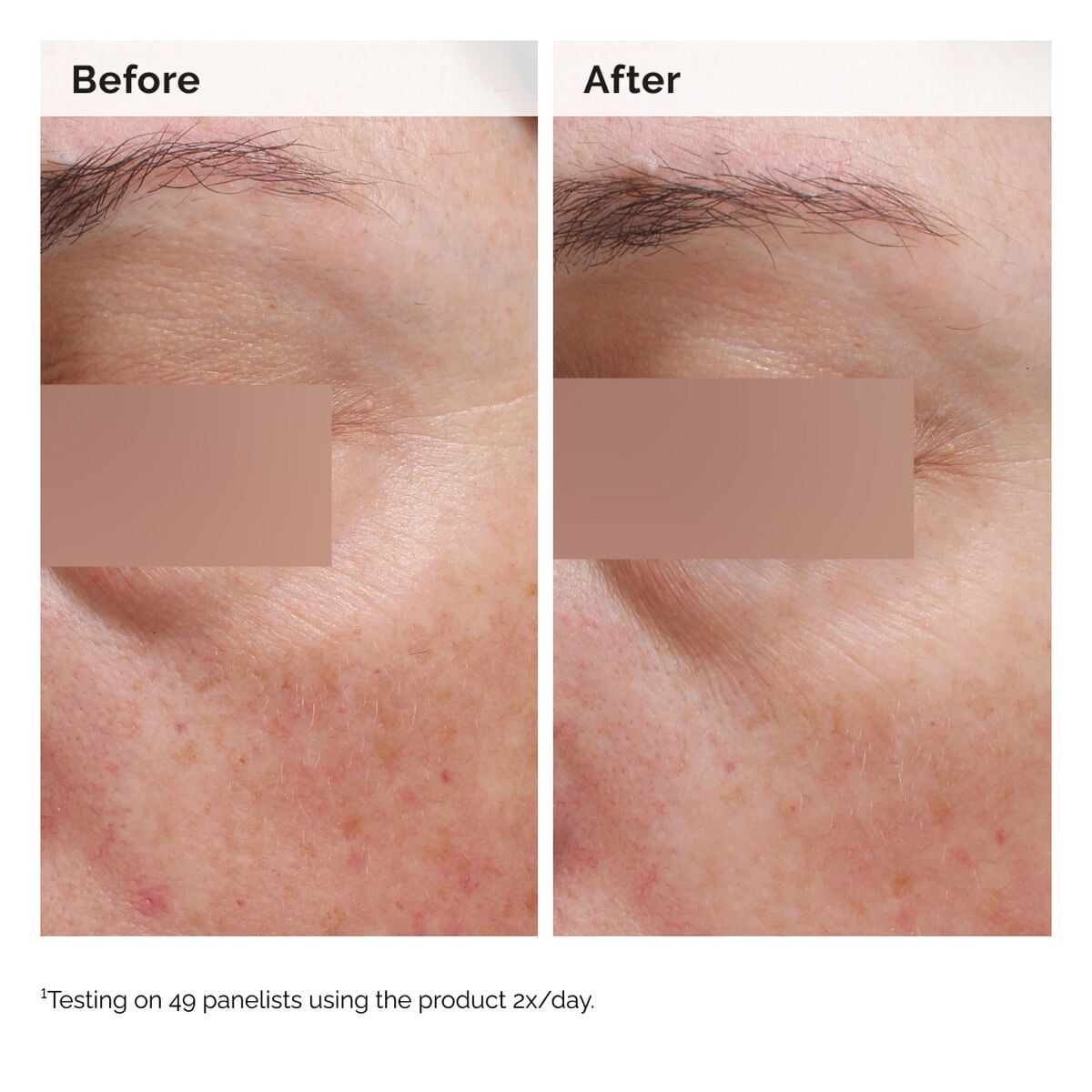 niacinamide-5-face-and-body-emulsion-a2 2024-08-23-ORD-Nia-5pct-Face-Body-B-A-Elasticity-Global-02-1x1.jpg