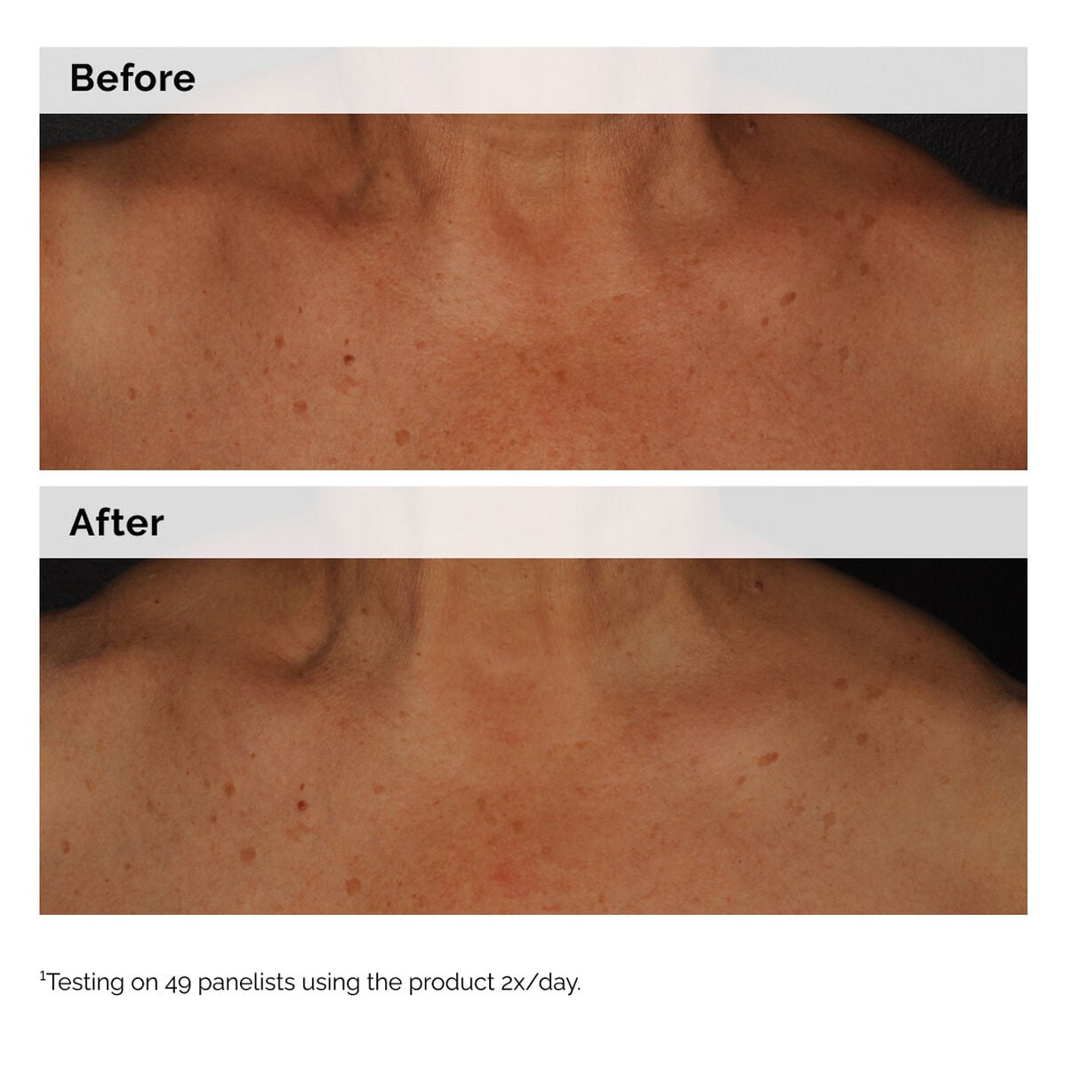 niacinamide-5-face-and-body-emulsion-a2 2024-08-23-ORD-Nia-5pct-Face-Body-B-A-Global-02-1x1.jpg