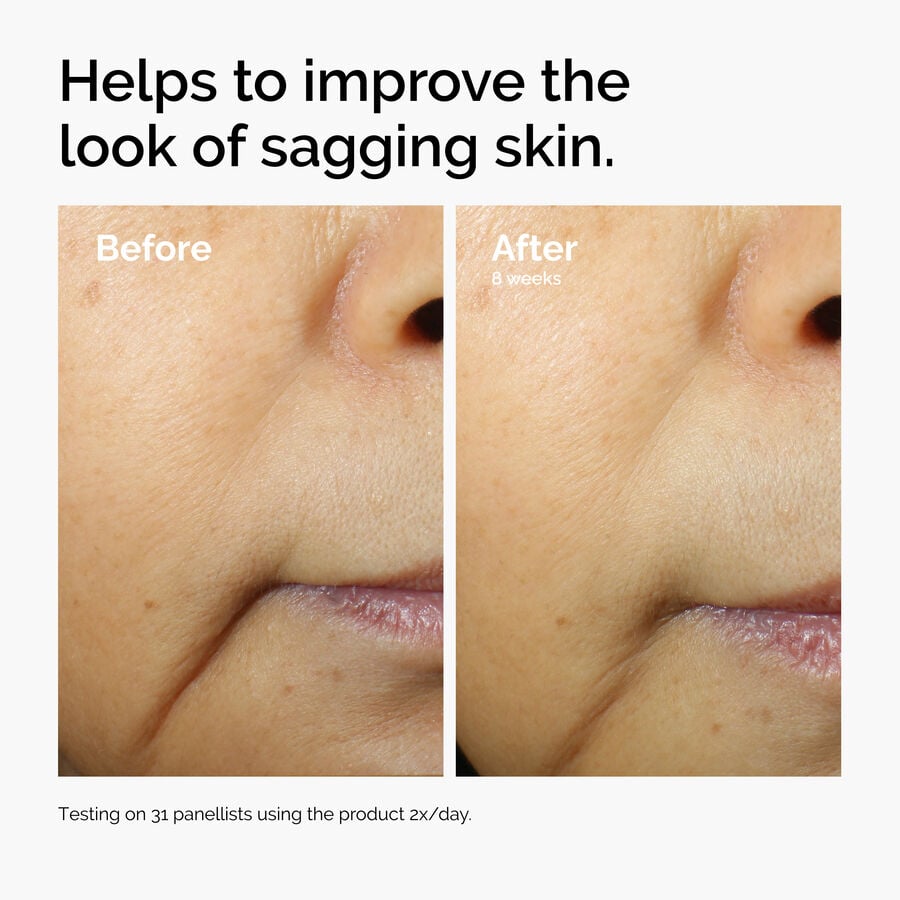 caffeine-3-escin-1-face-serum-i7 ord-caffeine-3pct-escin-1pct-face-serum-before-after-sagging.jpg