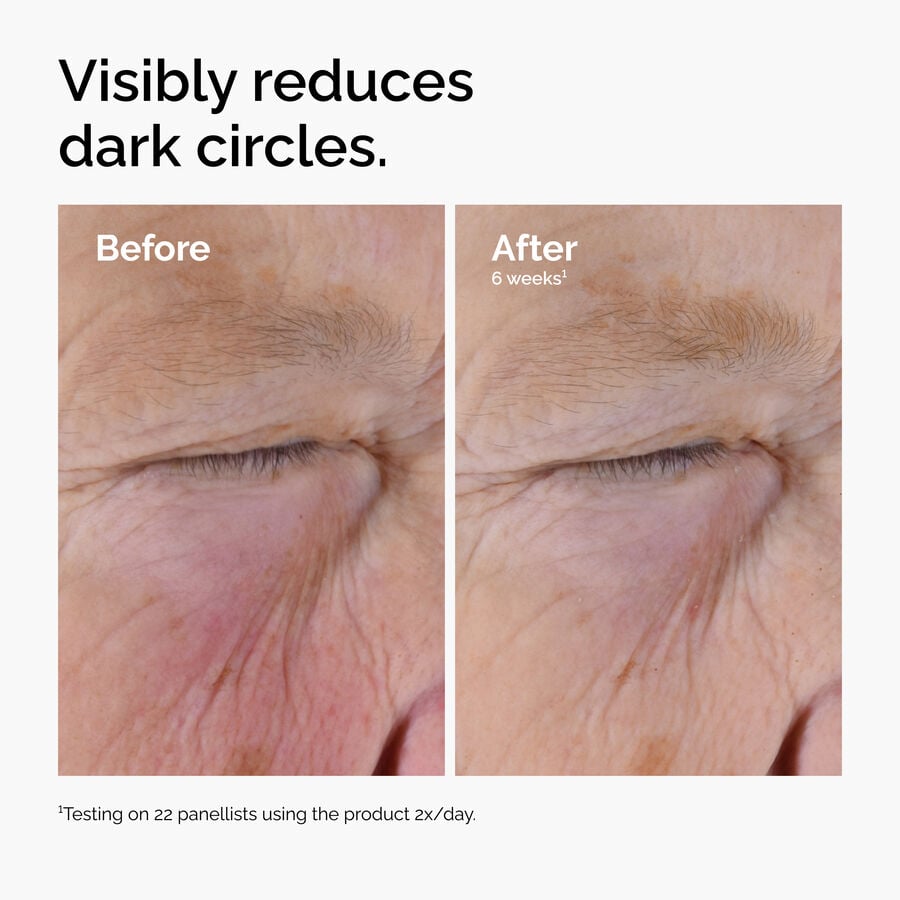 caffeine-solution-5-egcg-eye-serum-y7 ord-caffeine-solution-egcg-dark-circles-before-after.jpg