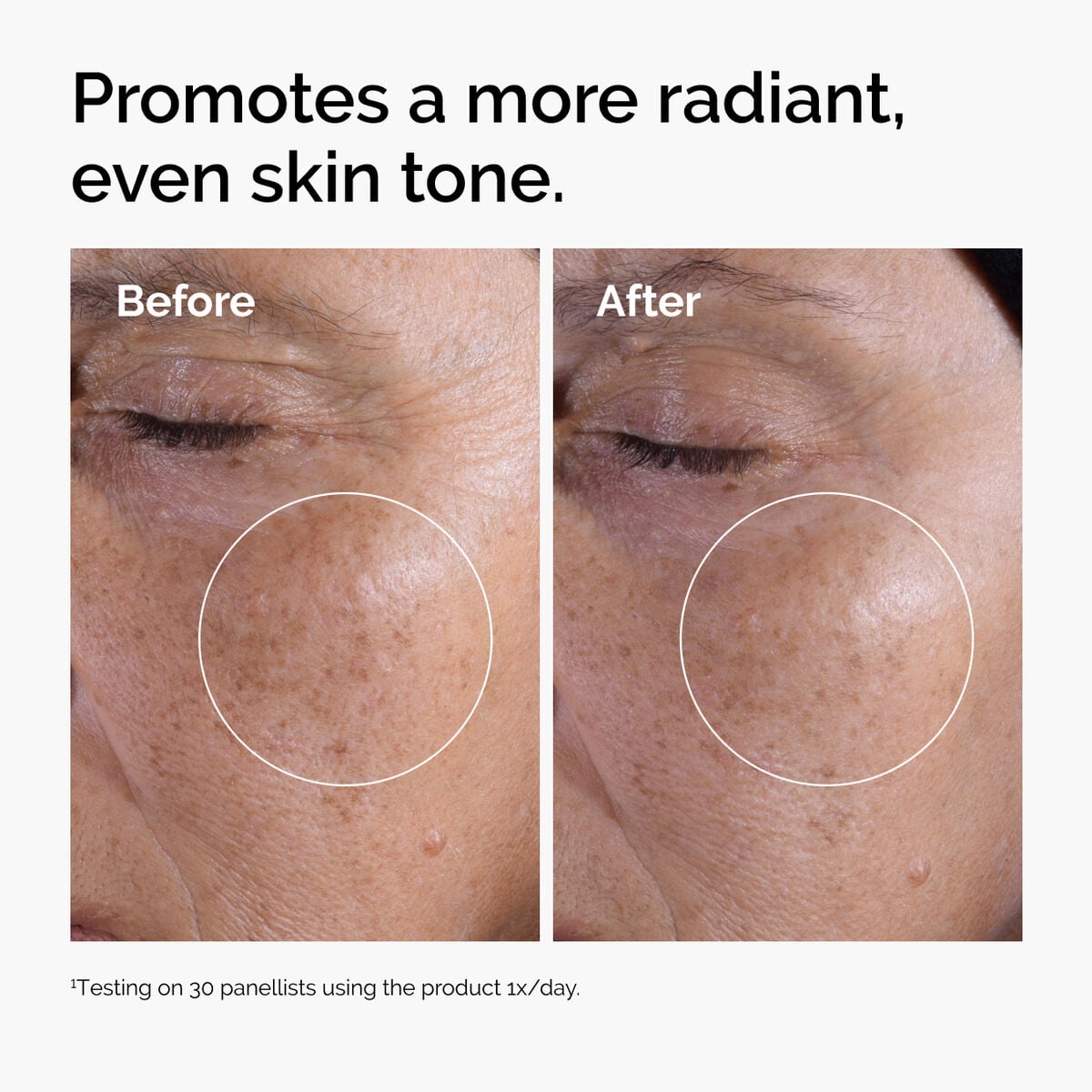 glycolic-acid-7-exfoliating-toner-v5 ord-glycolic-before-after-radiance.jpg