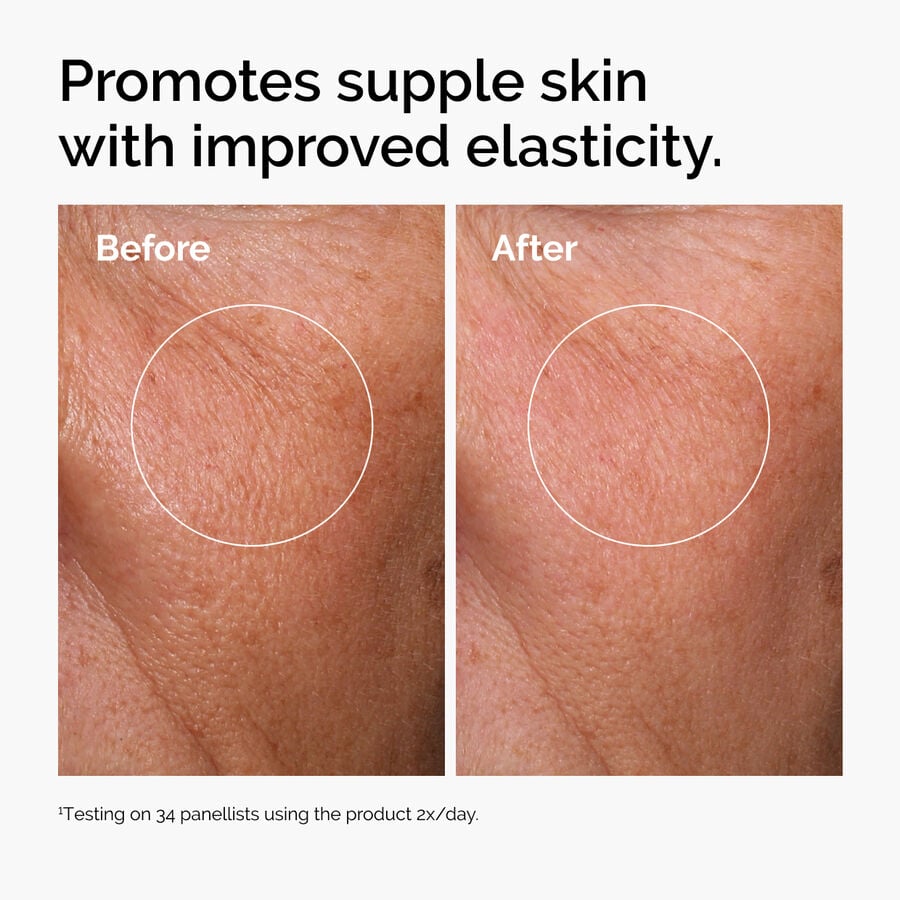 hyaluronic-acid-2-b5-with-ceramides-b4 ord-hyaluronic-acid-2pct-b5-hydrating-serum-before-after-elasticity.jpg
