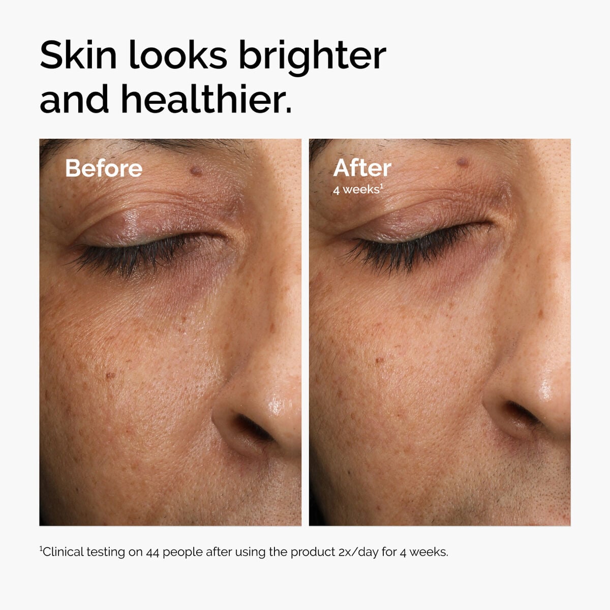 multi-antioxidant-radiance-serum-a4 ord-mars-before-after-healthy.jpg
