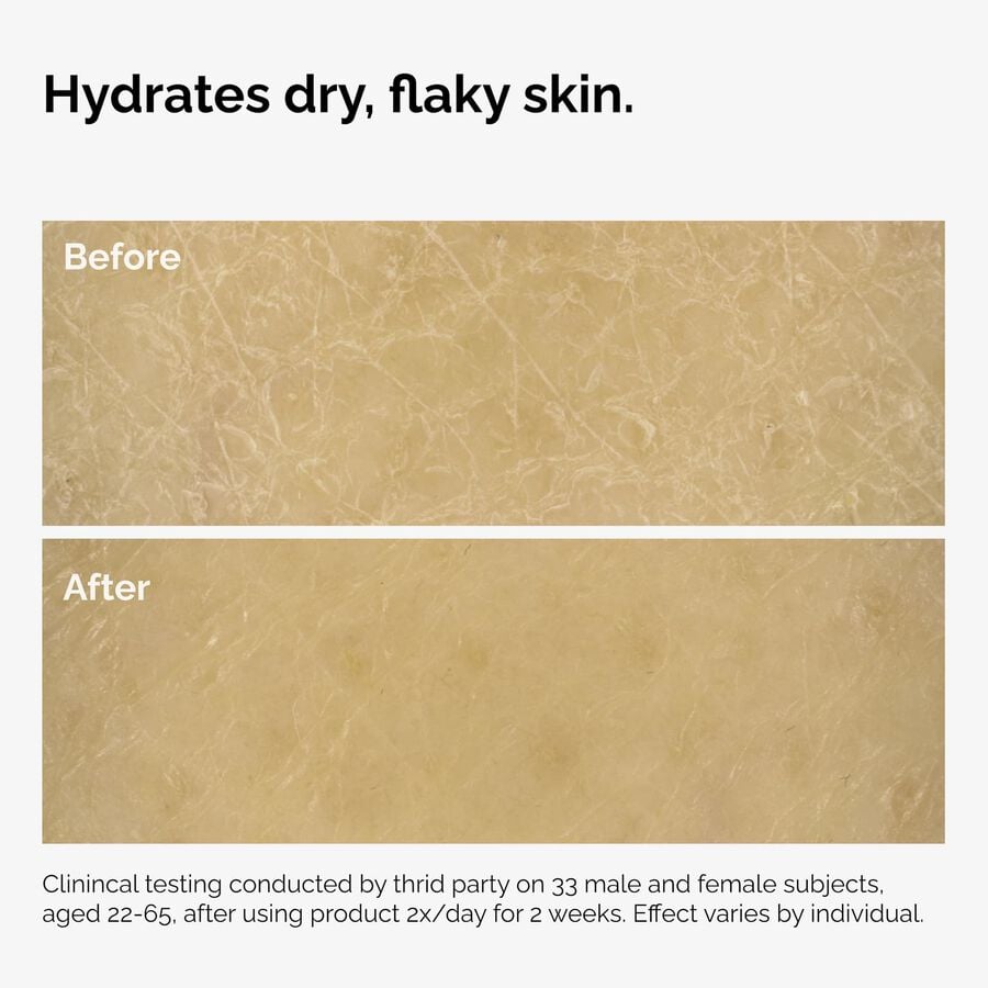the-body-care-collection-e6 ord-natural-moisturizing-factors-inulin-body-before-after-graphic-02.jpg
