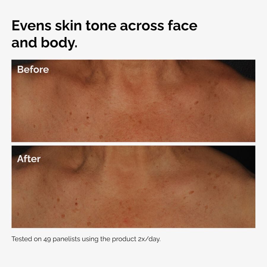 the-body-care-collection-e6 ord-niacinamide-face-body-serum-before-after-even-tone-graphic.jpg
