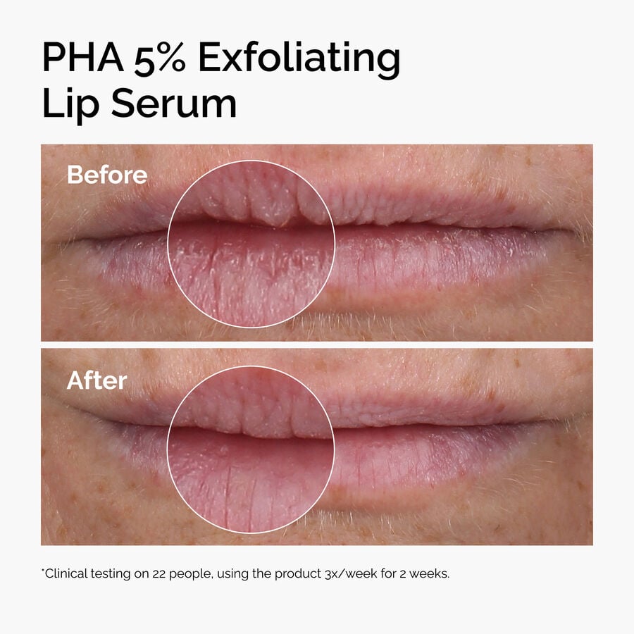 pha-5-exfoliating-lip-serum-j2 ord-pha-5pct-lip-exfoliating-serum-before-after.jpg