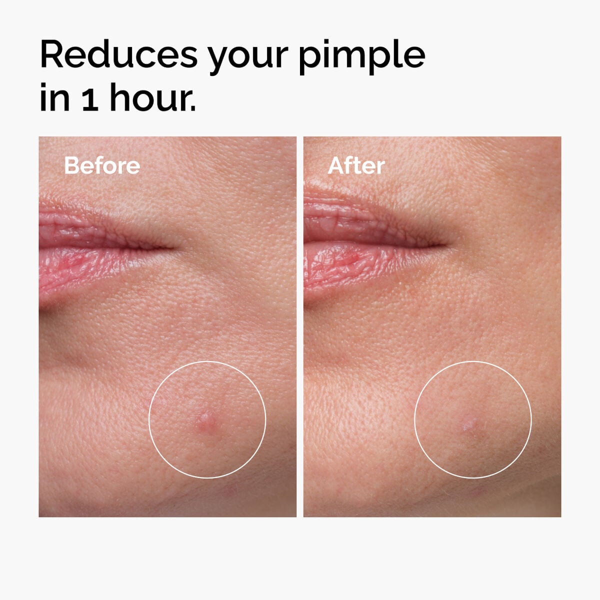 sulfur-10-powder-to-cream-concentrate-p4 ord-sulfur-10pct-powder-to-cream-concentrate-before-after-NA.jpg